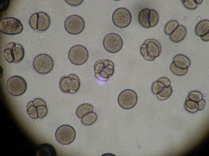embryo transfer success tips. microscope