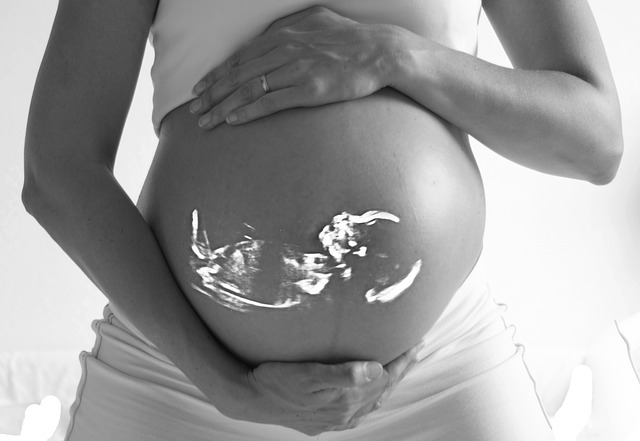 pregnant lady ultrasound image, IVF